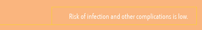 iud-facts_infection