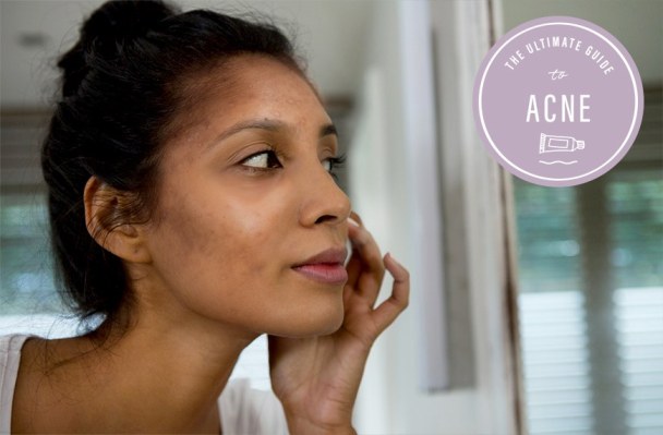 The Derm-Approved Ways to Deal With the Most Common Acne Scars