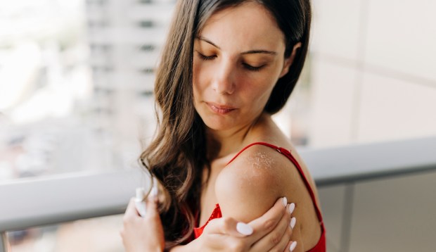 Psoriasis Flare-Ups Can Get Worse in the Summer—Here's How Dermatologists Want You To Deal