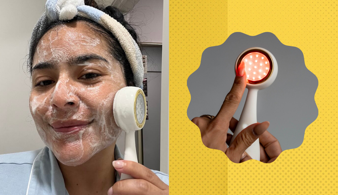 This 2-in-1 Facial Device Helped Clear the Acne Scars on My Cheeks in Just a Week