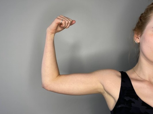 A close-up of the author's arms after she started running with Bala Bangles