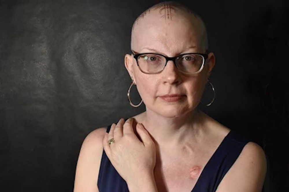 photo of a person looking straight at camera with a bald head and scalp tattoos, glasses, and silver hoop earrings